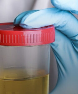 Proteína presente na urina pode sinalizar risco de demência; ENTENDA