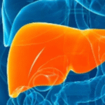 ESTEATOSE HEPÁTICA: o que é a gordura no fígado, quais riscos e como tratar