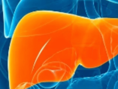 ESTEATOSE HEPÁTICA: o que é a gordura no fígado, quais riscos e como tratar