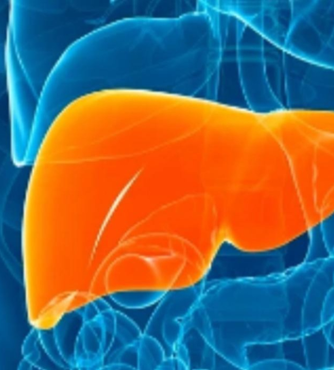 ESTEATOSE HEPÁTICA: o que é a gordura no fígado, quais riscos e como tratar