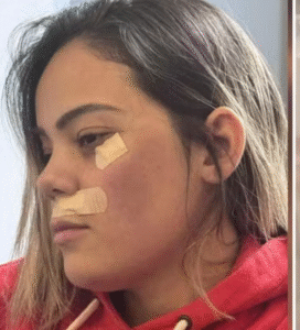 Brasileira sofre ataque e tentativa de estupro dentro de trem em Paris