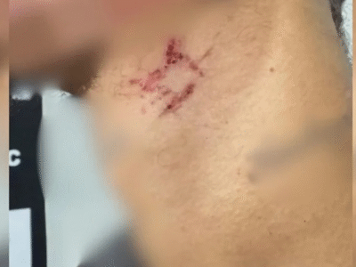 Escravo sexual de traficante é resgatado após passar mais de um ano em cárcere; VEJA VÍDEO