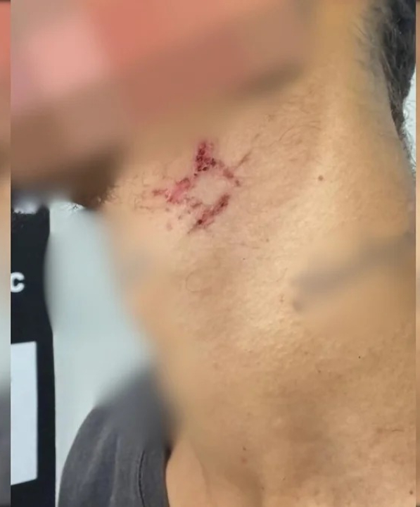 Escravo sexual de traficante é resgatado após passar mais de um ano em cárcere; VEJA VÍDEO