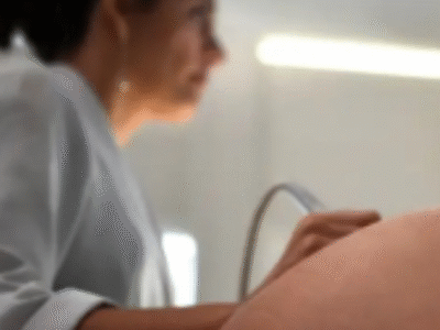 Comissão do Senado aprova PL que proíbe aborto após a 22ª semana