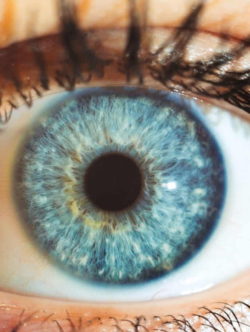 Este implante ocular promete restaurar a visão