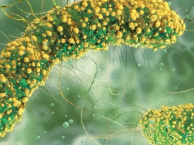 Massas instantâneas contaminadas por bactéria matam 6 pessoas