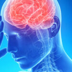 Médico revela 3 dicas para evitar AVC; Fique atento!