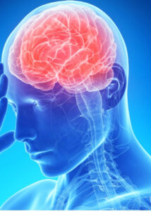 Médico revela 3 dicas para evitar AVC; Fique atento!