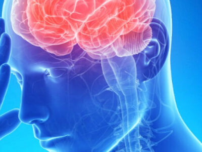 Médico revela 3 dicas para evitar AVC; Fique atento!