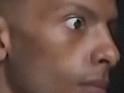 Jovem intoxicado por Metanol perde 10kg e está cego; VEJA VÍDEO