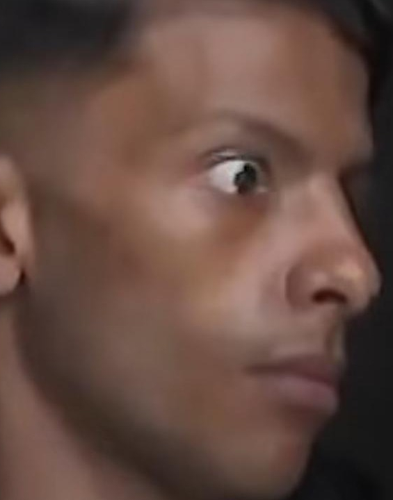 Jovem intoxicado por Metanol perde 10kg e está cego; VEJA VÍDEO