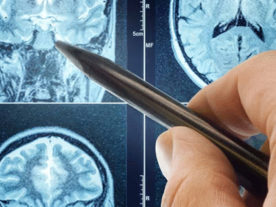 Famoso remédio para pressão alta surpreende ao impedir avanço de tumor cerebral
