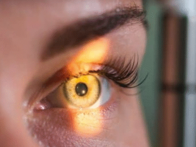 Nova abordagem pode restaurar visão em olho com ambliopia