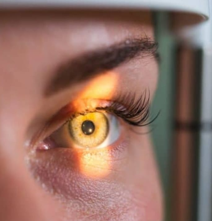 Nova abordagem pode restaurar visão em olho com ambliopia