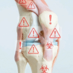 Os 5 erros que estão acabando com a saúde do seu joelho