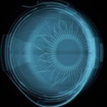 Córnea impressa em 3D devolve visão a paciente pela primeira vez na medicina