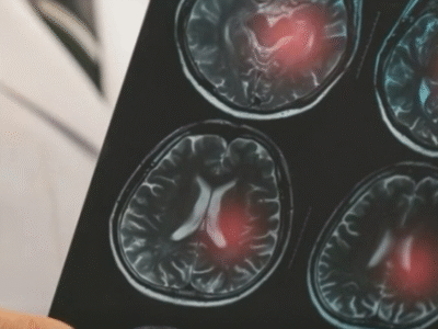 Chega a vez dos médicos: Senado aprova o teste que será o novo filtro para quem acabou de se formar