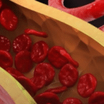 Cardiologista apontam o que precisa ser feito para ‘limpar’ as artérias; VEJA