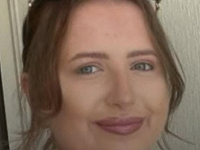 Jovem descobre metástase 24 anos após sintoma comum