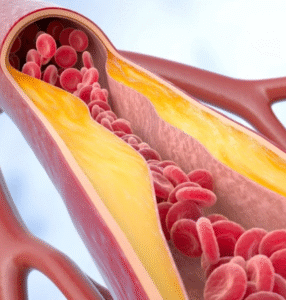 Médico vascular lista os melhores vegetais para a saúde das artérias