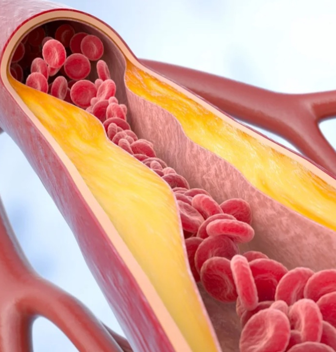 Médico vascular lista os melhores vegetais para a saúde das artérias