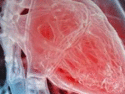 Cardiologista aponta sintomas que podem indicar problema no coração; VEJA