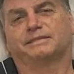 URGENTE: Bolsonaro diagnosticado com hérnias inguinais na PF: cirurgia é o único tratamento, diz equipe médica