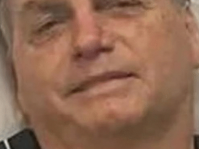 URGENTE: Bolsonaro diagnosticado com hérnias inguinais na PF: cirurgia é o único tratamento, diz equipe médica
