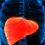 Gordura no fígado: como identificar os sintomas da doença silenciosa