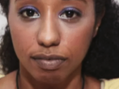 Doença rara faz mulher ter 50 orgasmos por dia