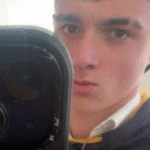 Adolescente perde pedaços do pulmão por vício em cigarro eletrônico