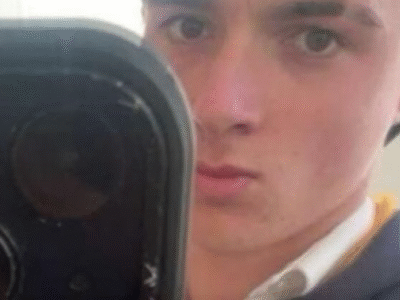 Adolescente perde pedaços do pulmão por vício em cigarro eletrônico