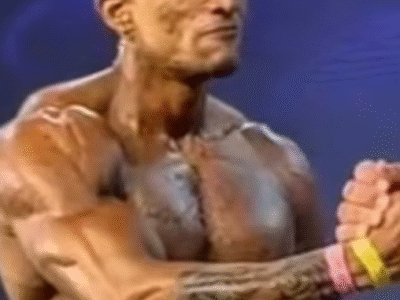 Fisiculturista morre após infecção por bactéria ‘devoradora de carne’