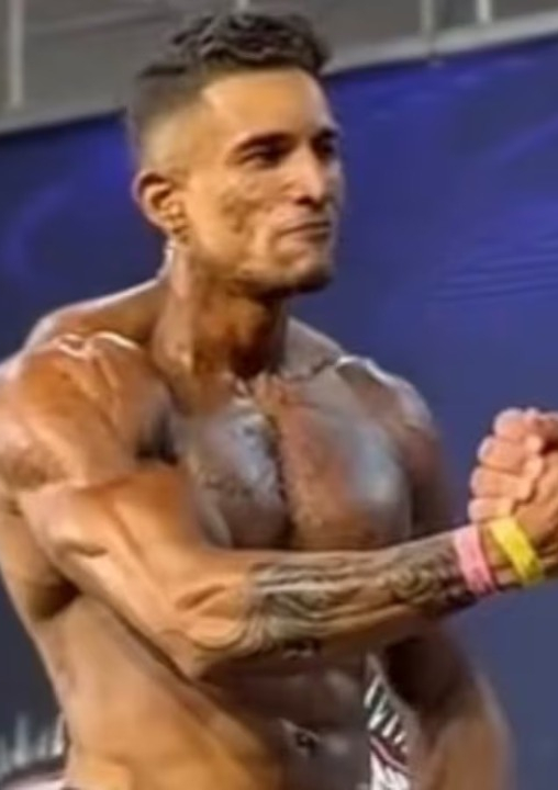 Fisiculturista morre após infecção por bactéria ‘devoradora de carne’