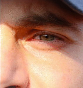 “Trend” nas redes sociais, raspar os cílios pode causar lesões nos olhos. Tendência que viralizou entre homens expõe os olhos a riscos de inflamações, infecções e até danos permanentes à visão