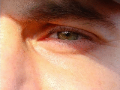 “Trend” nas redes sociais, raspar os cílios pode causar lesões nos olhos. Tendência que viralizou entre homens expõe os olhos a riscos de inflamações, infecções e até danos permanentes à visão