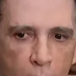 Exames confirmam traumatismo craniano em Bolsonaro diz médico; VEJA VIDEO