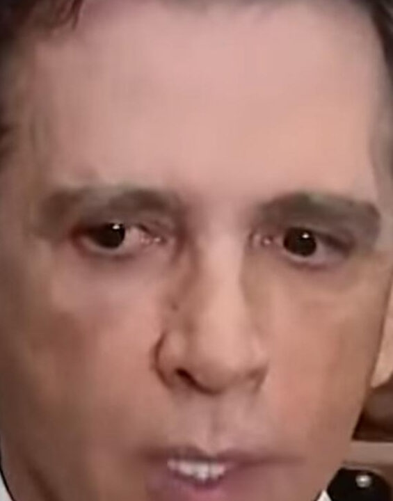 Exames confirmam traumatismo craniano em Bolsonaro diz médico; VEJA VIDEO