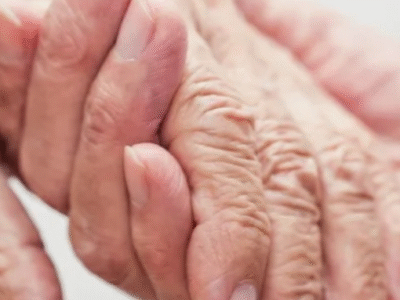 Anvisa aprova medicamento para pacientes com Alzheimer em fase inicial