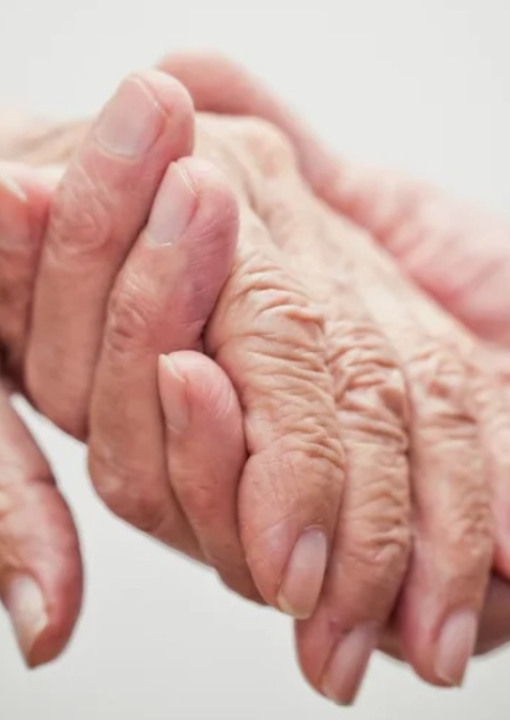 Anvisa aprova medicamento para pacientes com Alzheimer em fase inicial