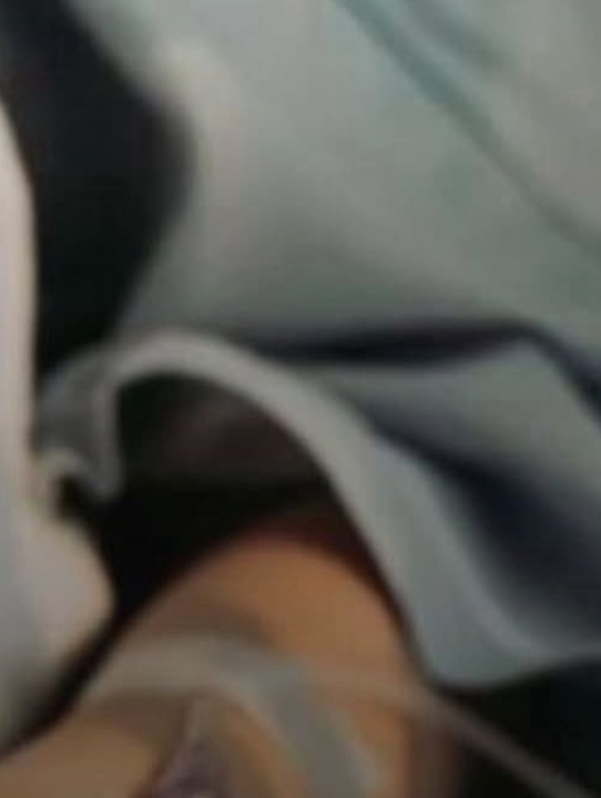 Neurologista explica o que é o coma e principais causas da emergência