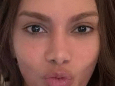 ANITTA VENCE DISPUTA E BARRA USO DO NOME POR EMPRESA DE REMEDIO DE VERMES