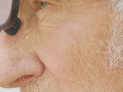 Óculos inteligentes ajudam pessoas com demência a lembrar nomes