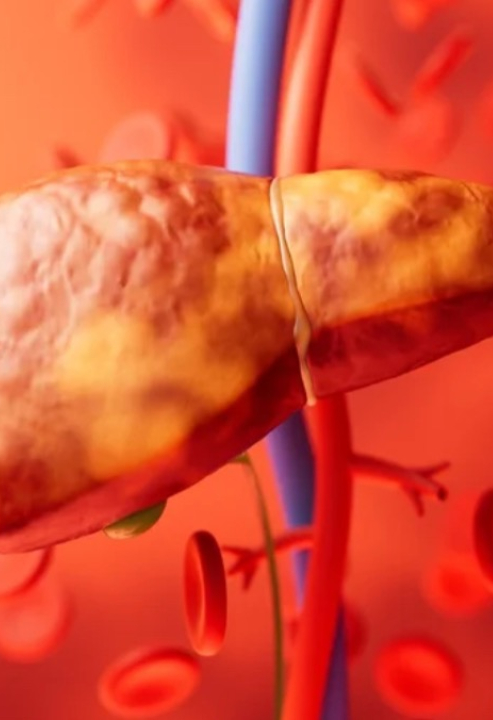 Hepatologista explica o que mais tende a provocar o colapso do fígado