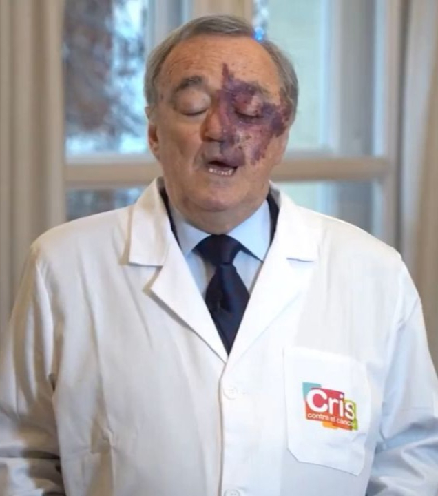 Cientistas espanhóis conseguem eliminar completamente o câncer pancreático em ratos com uma combinação de três medicamentos.