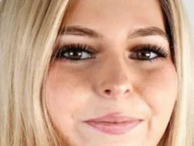 Jovem morre de câncer após médicos ignorarem sintomas: “Muito nova”