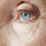 Cirurgia de catarata reduz a insônia. Pesquisa mostra que 36% das mulheres brasileiras tem insônia que melhora após cirurgia. Entenda