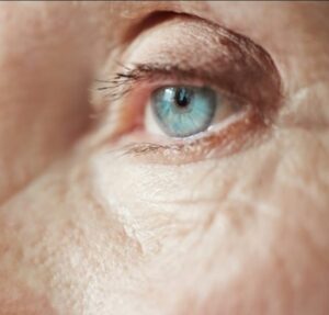 Cirurgia de catarata reduz a insônia. Pesquisa mostra que 36% das mulheres brasileiras tem insônia que melhora após cirurgia. Entenda