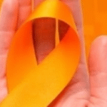 Conscientização sobre a leucemia no Fevereiro Laranja é realizada pela Santa Casa de Marília com ações de orientação aos públicos interno e externo. Saiba importância