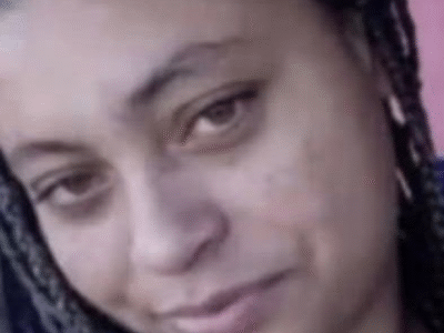 Caso impressionante: mulher atropelada e dada como morta recebe alta em SP